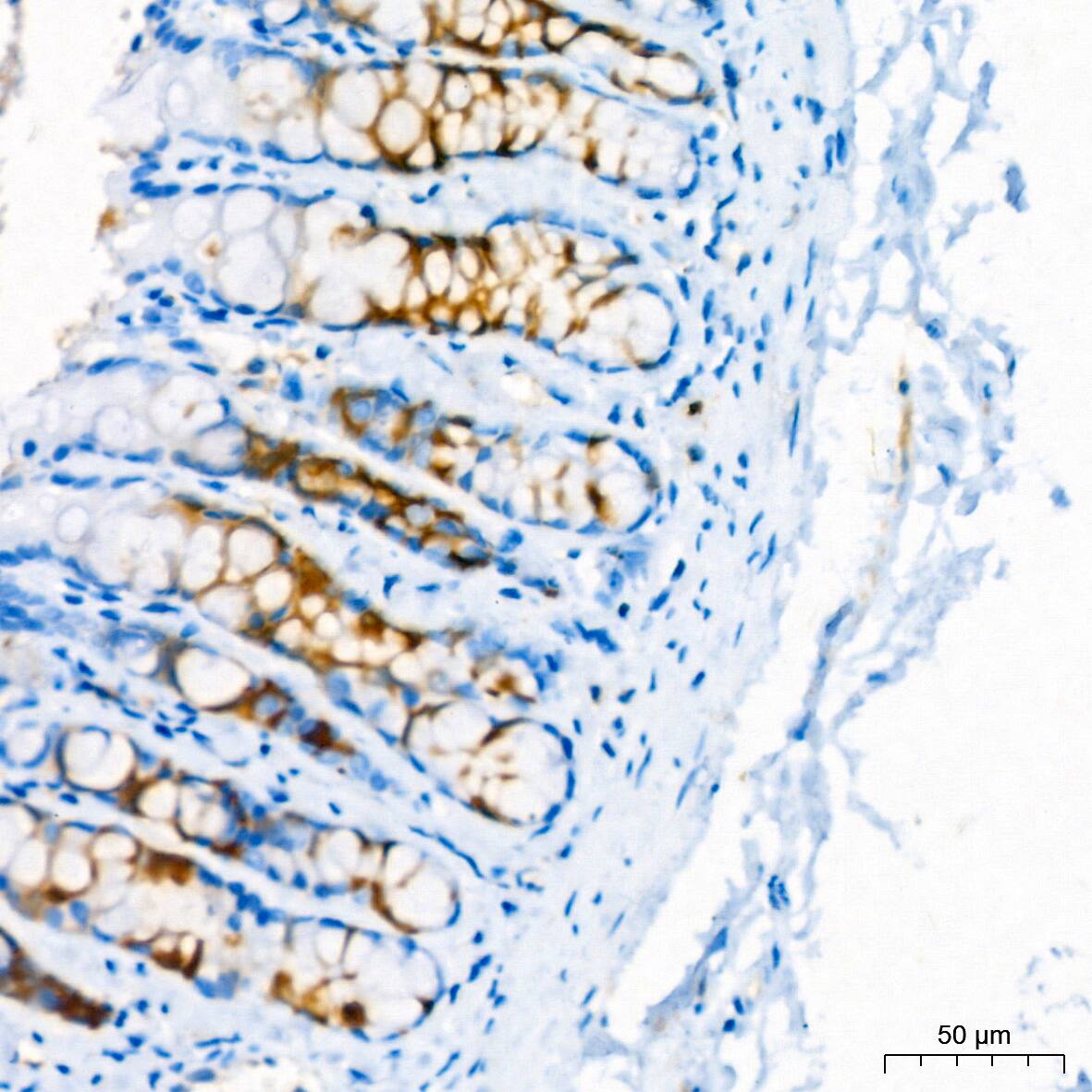 Stathmin 1 Antibody (7Y7H4)