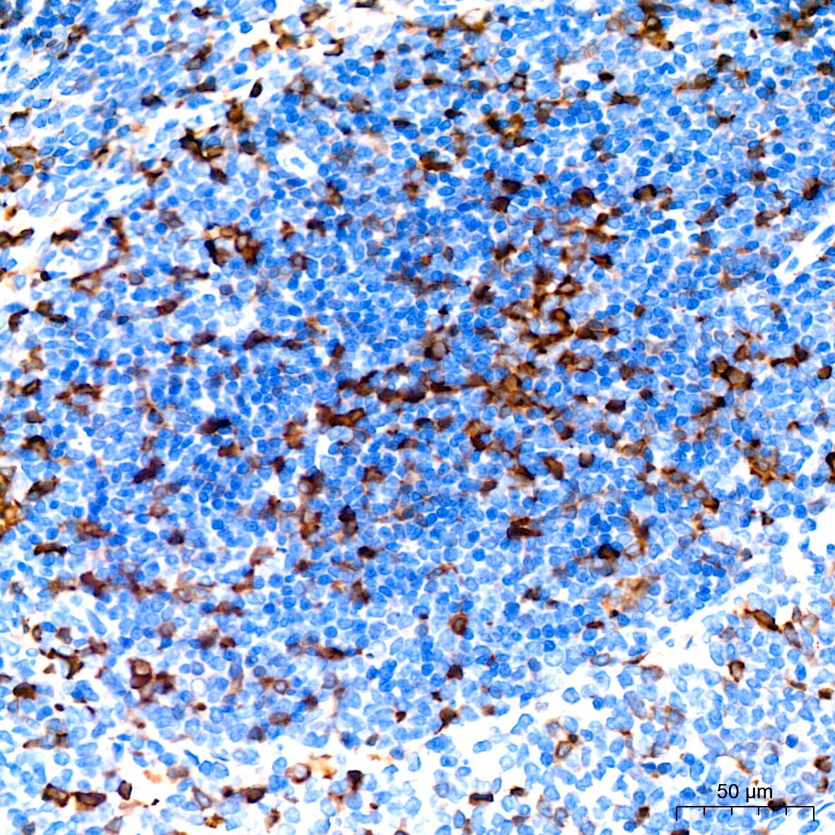 Stathmin 1 Antibody (7Y7H4)
