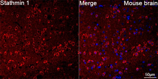 Stathmin 1 Antibody (7Y7H4)