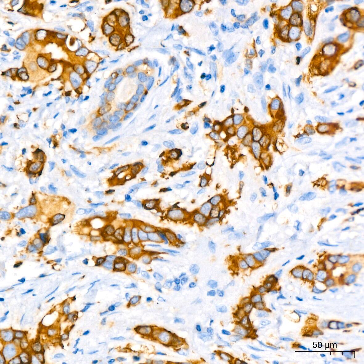 Stathmin 1 Antibody (7Y7H4)