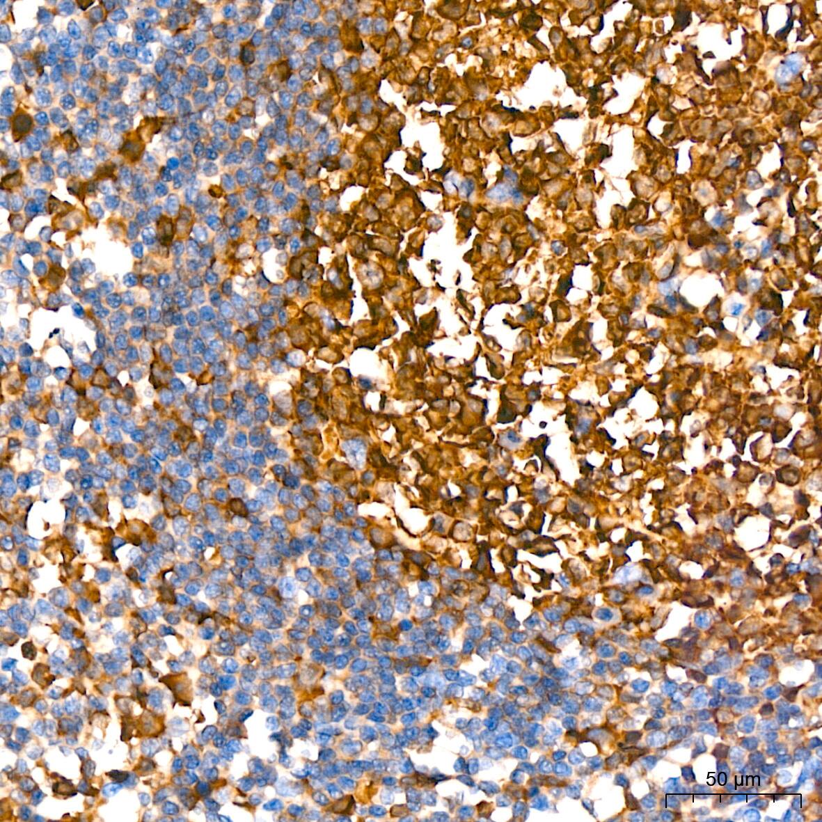 Stathmin 1 Antibody (7Y7H4)