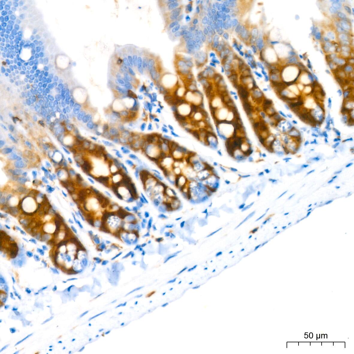Stathmin 1 Antibody (7Y7H4)