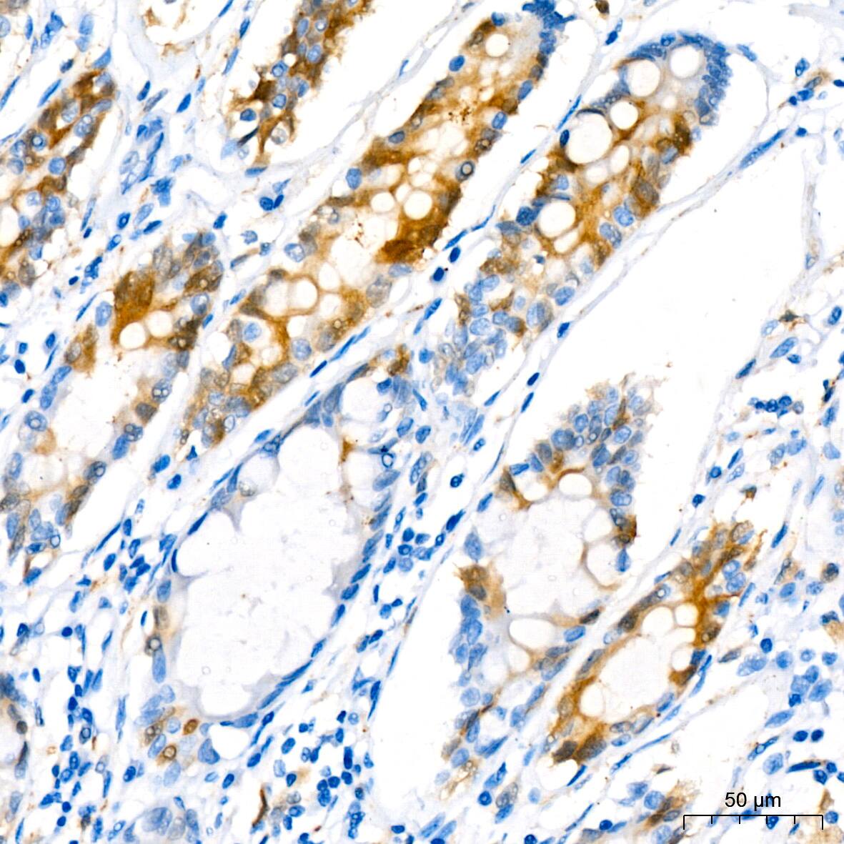 Stathmin 1 Antibody (7Y7H4)