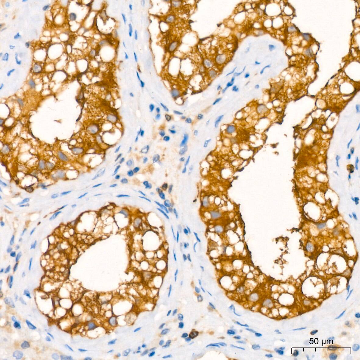 Stathmin 1 Antibody (7Y7H4)