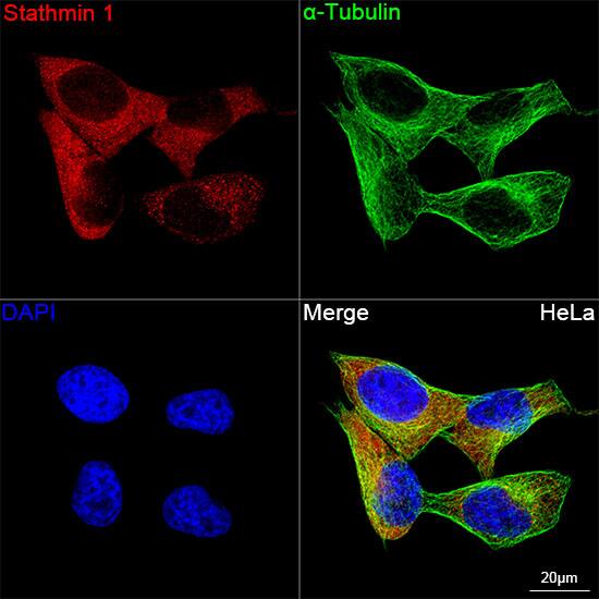 Stathmin 1 Antibody (7Y7H4)