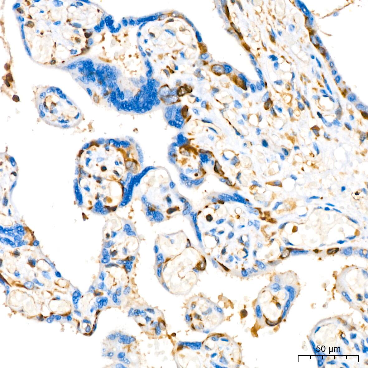 Stathmin 1 Antibody (7Y7H4)