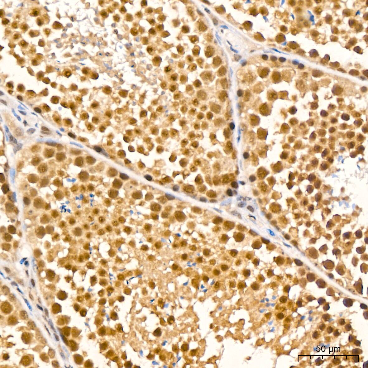 UBE2I/Ubc9 Antibody (6Z9V6)