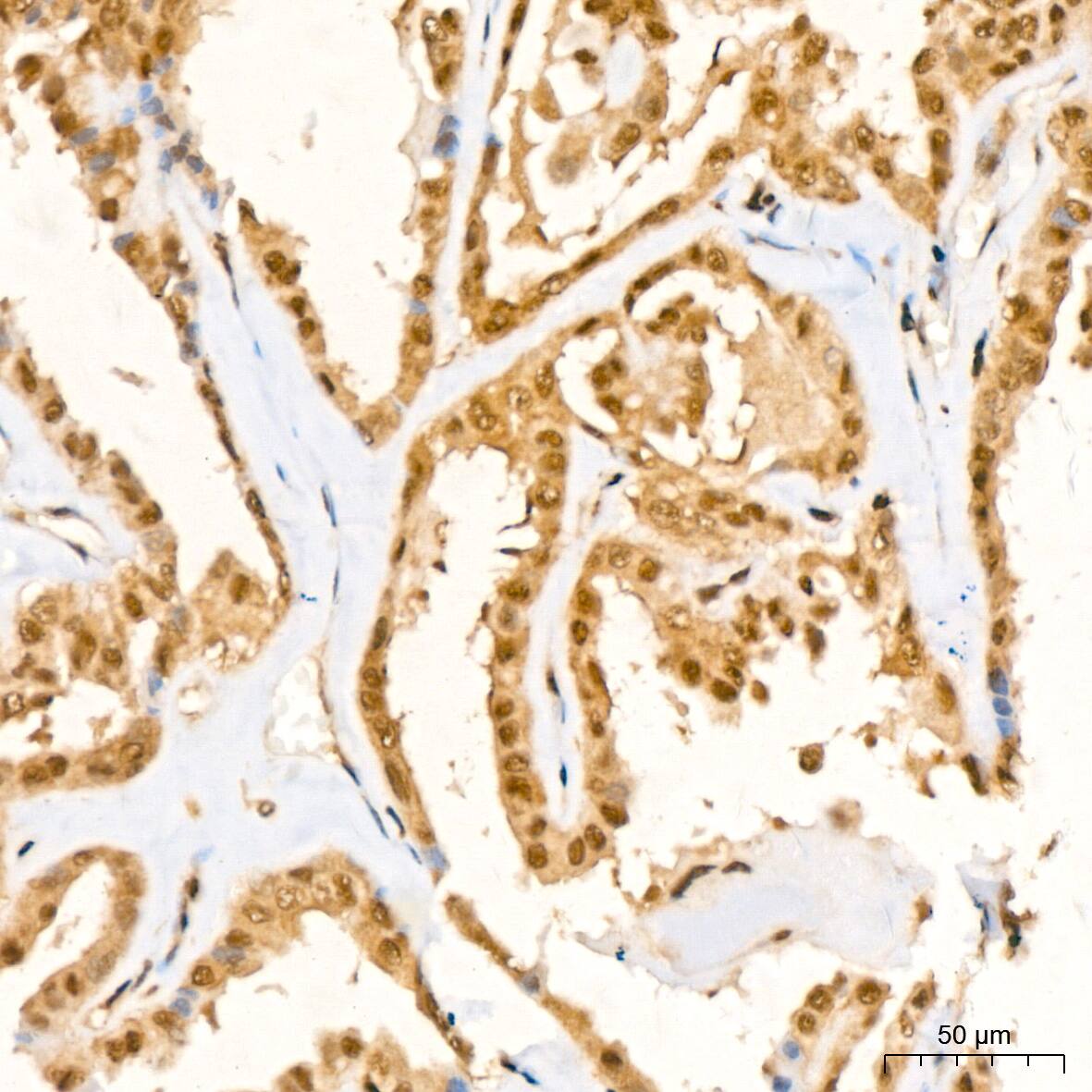UBE2I/Ubc9 Antibody (6Z9V6)