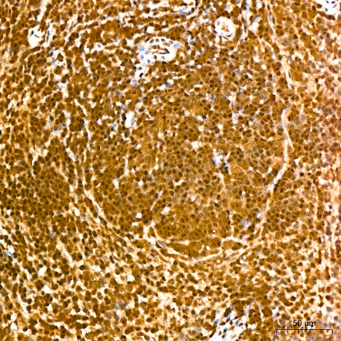 UBE2I/Ubc9 Antibody (6Z9V6)