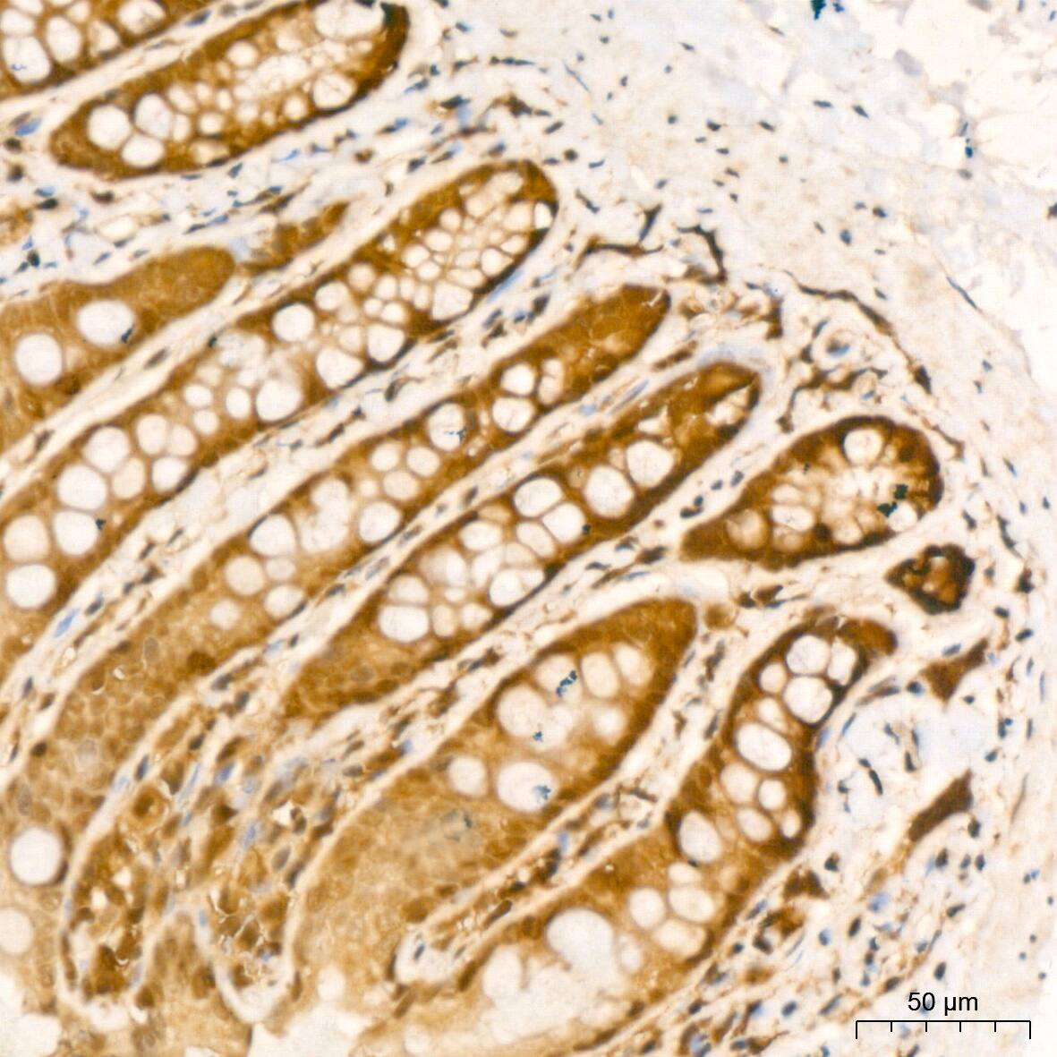 UBE2I/Ubc9 Antibody (6Z9V6)