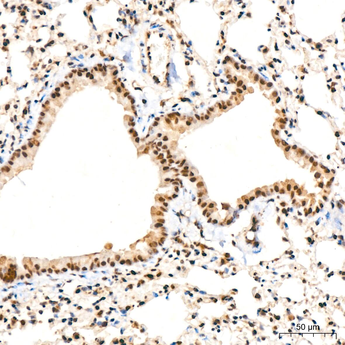 UBE2I/Ubc9 Antibody (6Z9V6)
