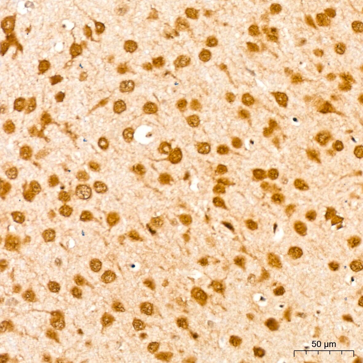 UBE2I/Ubc9 Antibody (6Z9V6)