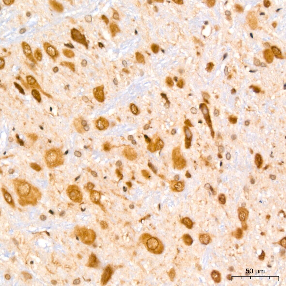 UBE2I/Ubc9 Antibody (6Z9V6)