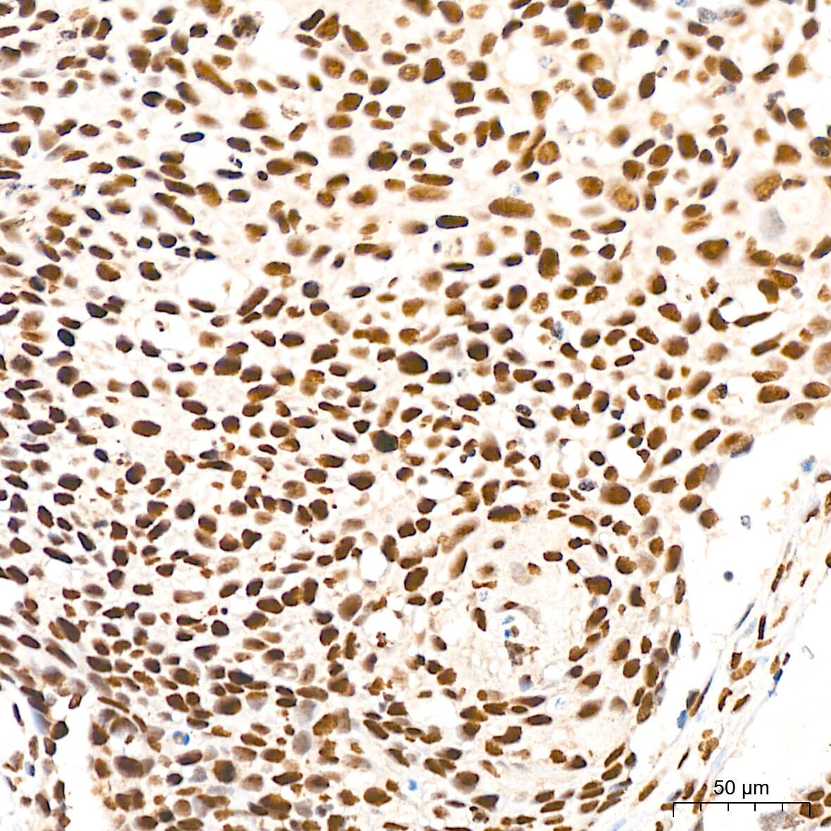 DKC1 Antibody (2W2V6)