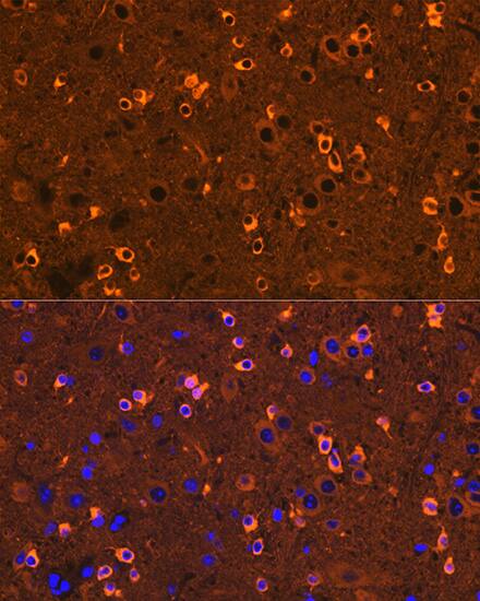 CRMP2 Antibody (0A1T1)