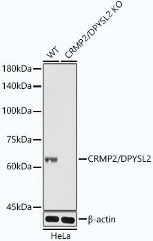 CRMP2 Antibody (0A1T1)