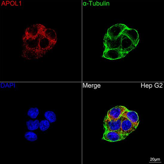Apolipoprotein L1 Antibody (1A8N2)