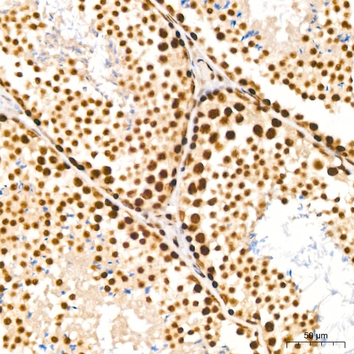 NuMA Antibody (6D4I4)