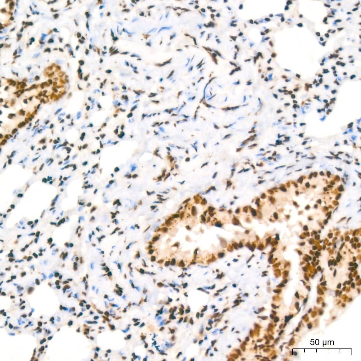 NuMA Antibody (6D4I4)