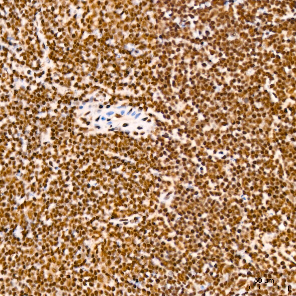 NuMA Antibody (6D4I4)