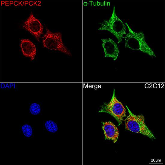 PCK2 Antibody (10L10J8)
