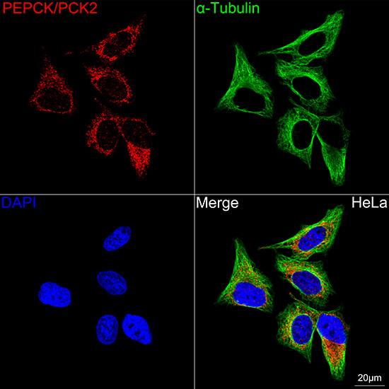 PCK2 Antibody (10L10J8)