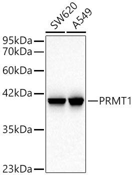 PRMT1 Antibody (10W10U4)