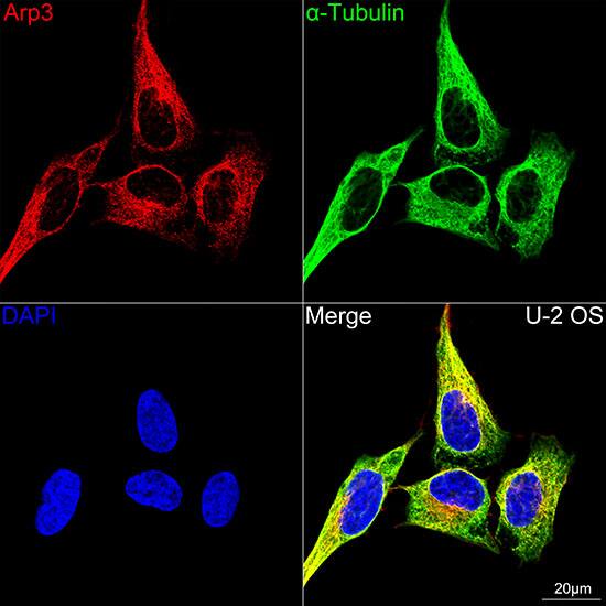 ACTR3 Antibody (8K4F2)