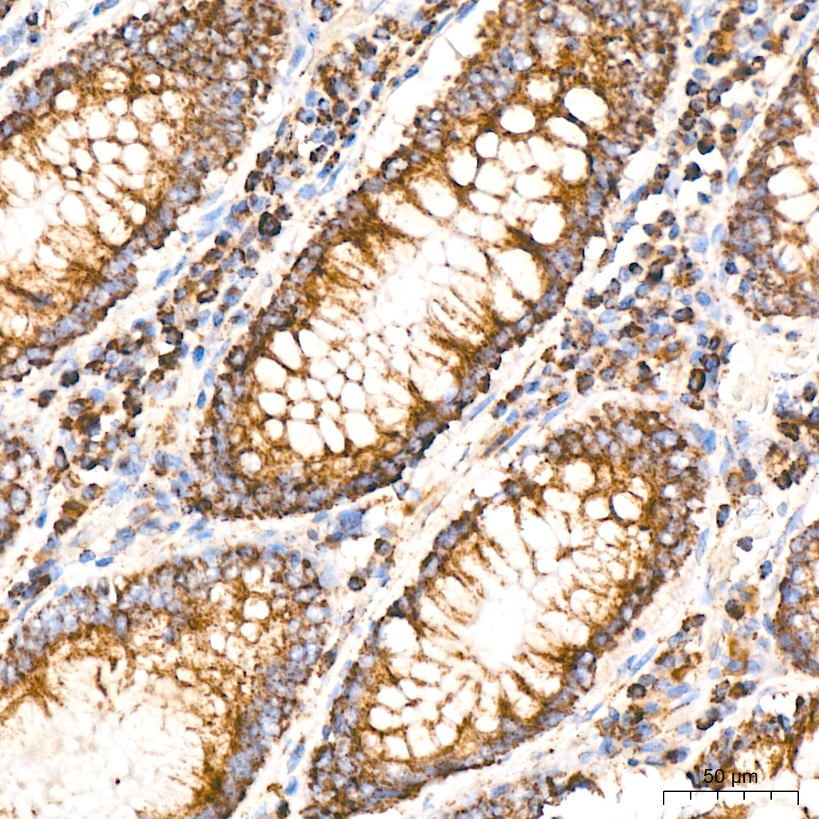 Aconitase 2 Antibody (0P3H3)
