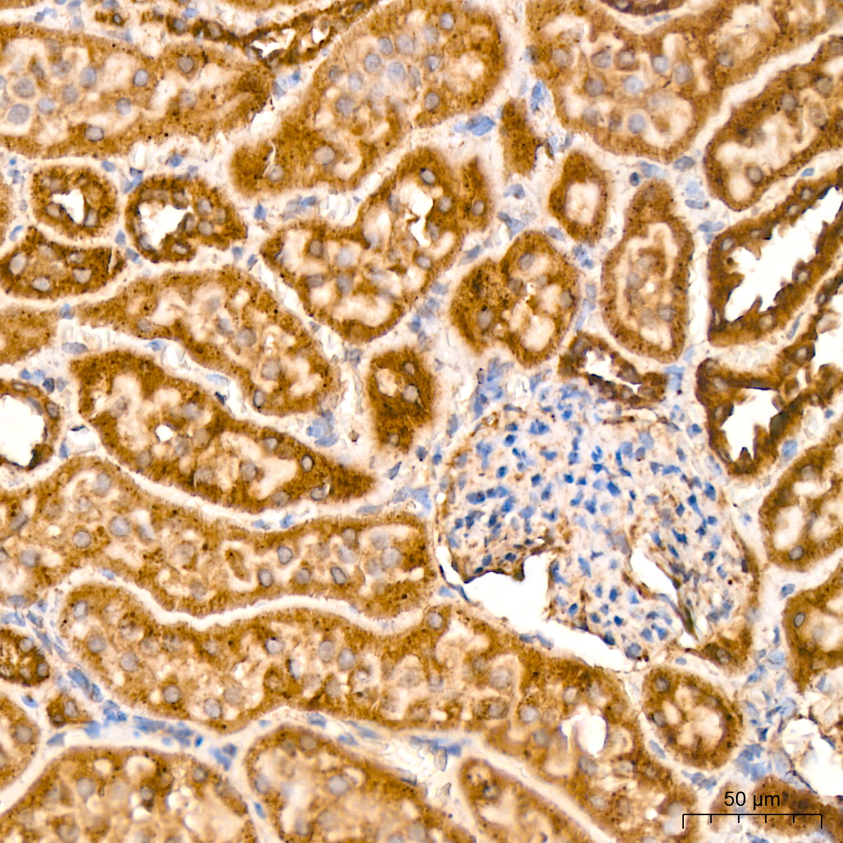 Aconitase 2 Antibody (0P3H3)