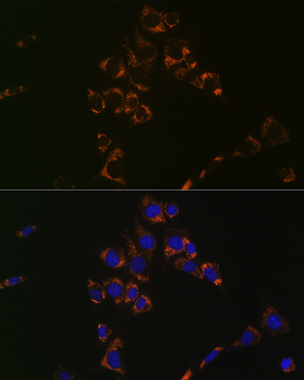 Aconitase 2 Antibody (0P3H3)
