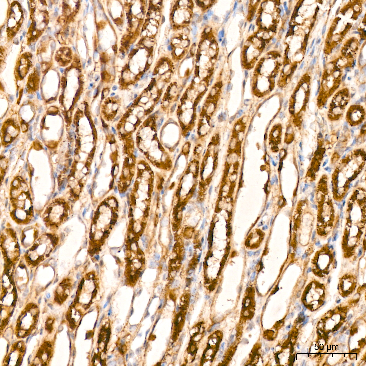 Aconitase 2 Antibody (0P3H3)