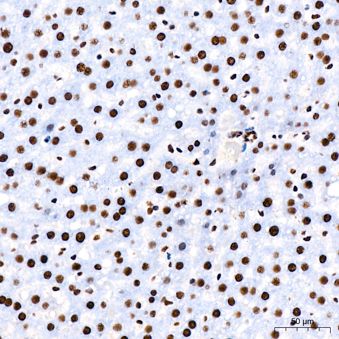 RNA Helicase A Antibody (2I6C5)