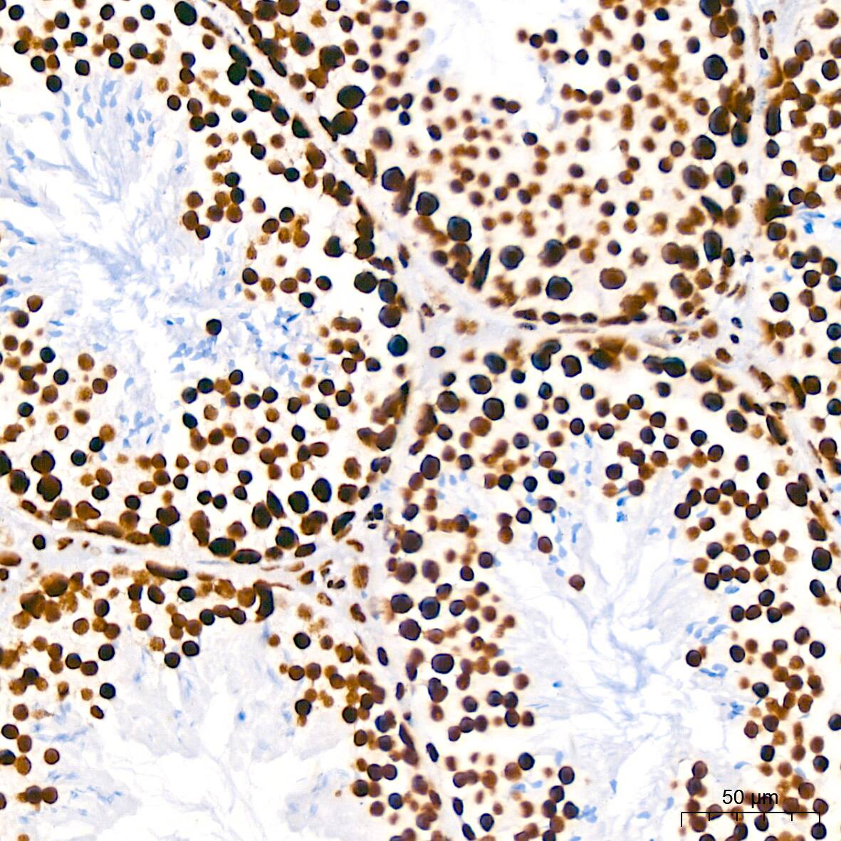 RNA Helicase A Antibody (2I6C5)