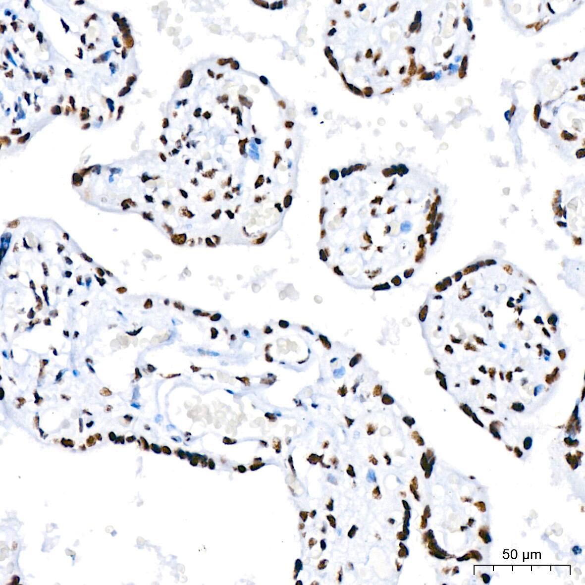 RNA Helicase A Antibody (2I6C5)