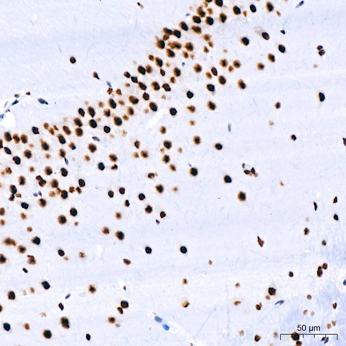 RNA Helicase A Antibody (2I6C5)