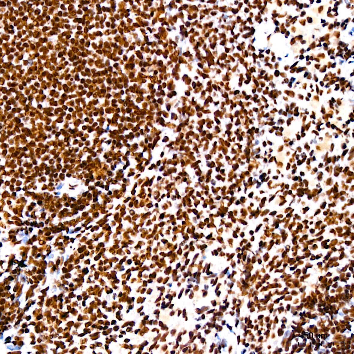 RNA Helicase A Antibody (2I6C5)