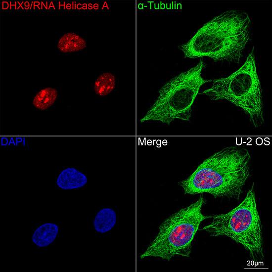 RNA Helicase A Antibody (2I6C5)