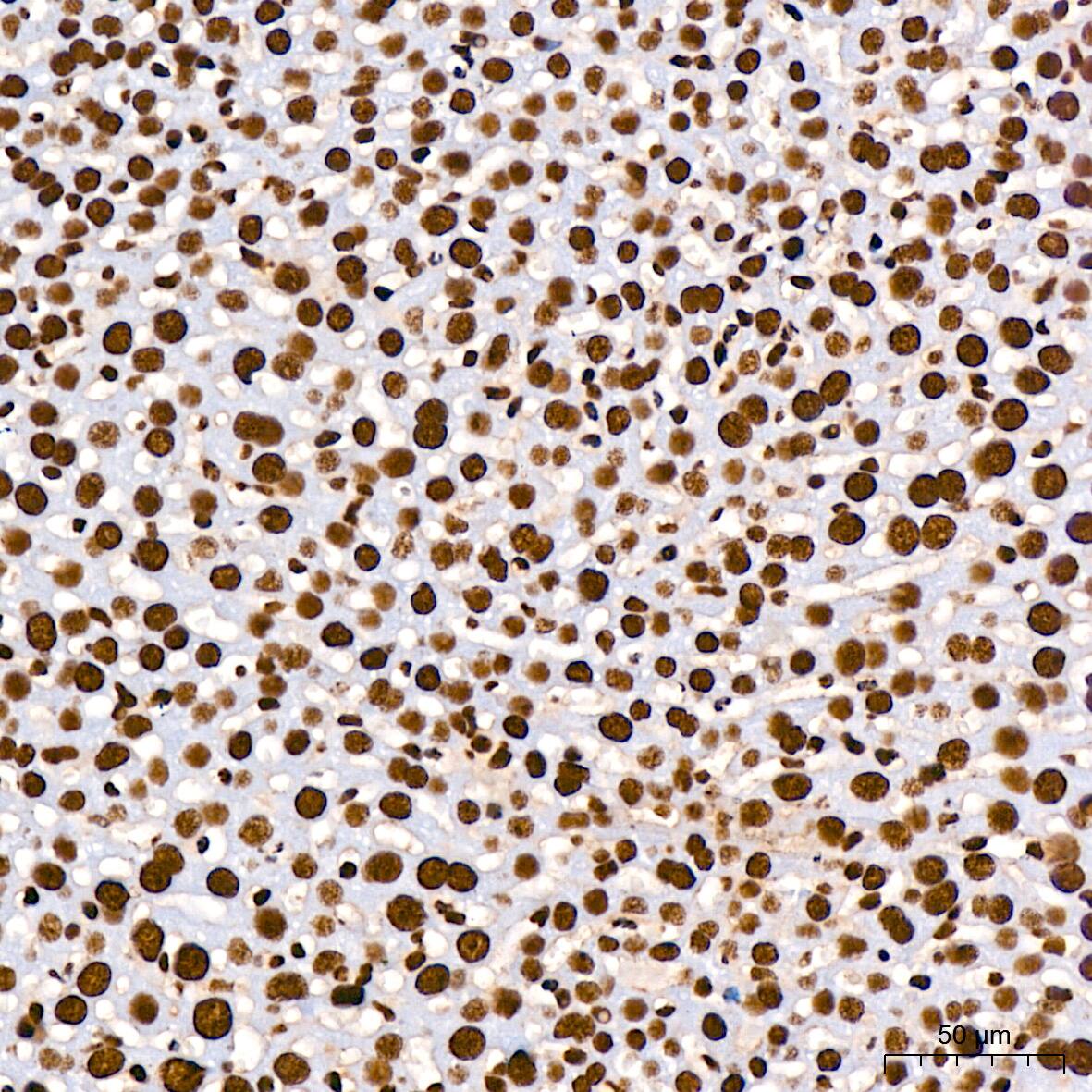 RNA Helicase A Antibody (2I6C5)