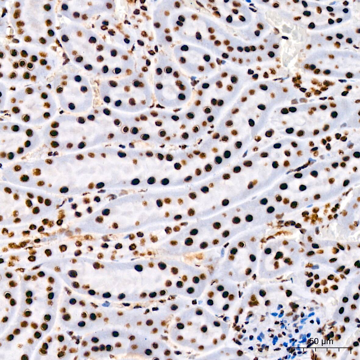 RNA Helicase A Antibody (2I6C5)