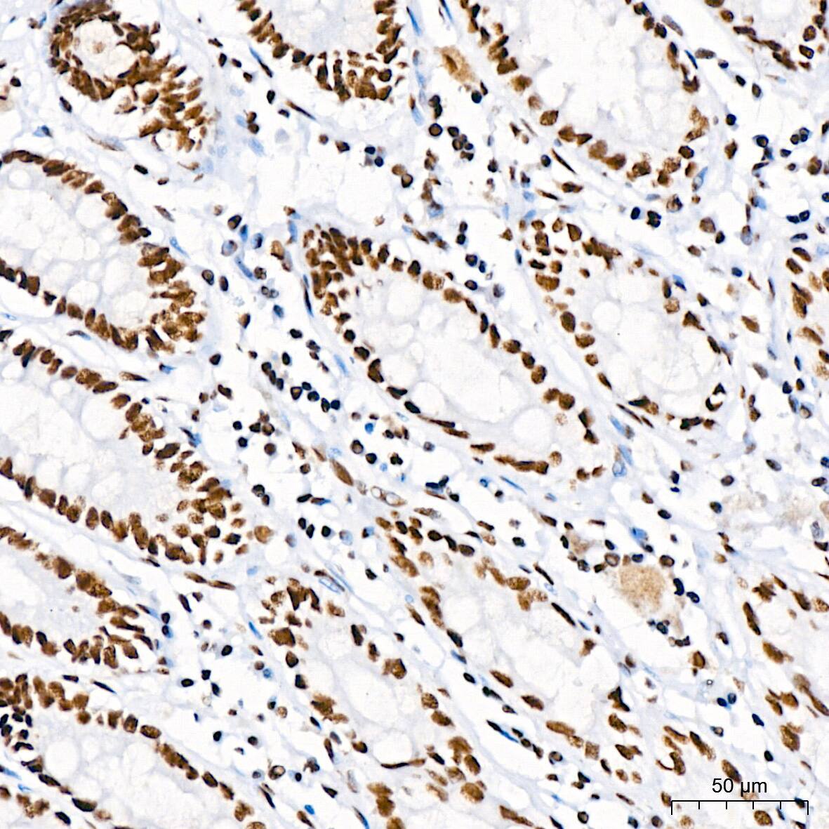 RNA Helicase A Antibody (2I6C5)