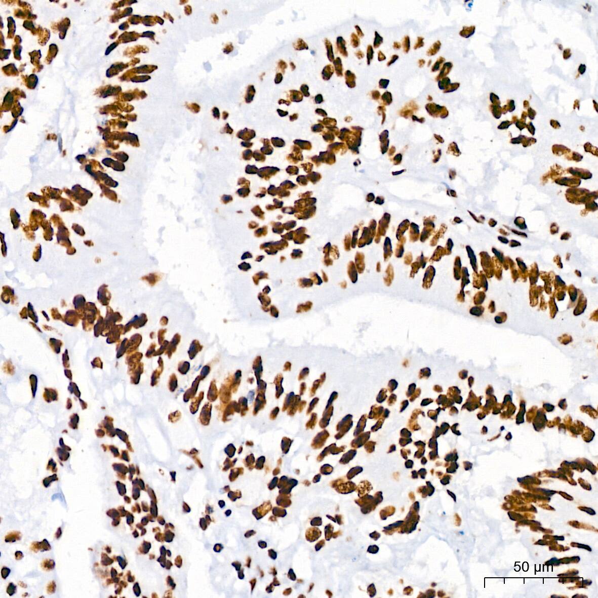 RNA Helicase A Antibody (2I6C5)