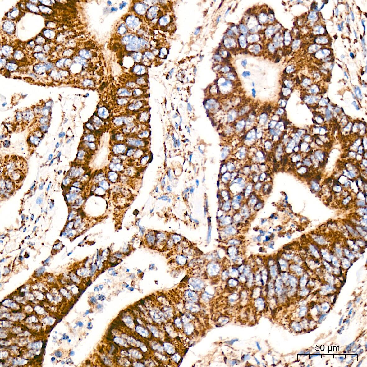 CS Citrate Synthase Antibody (4Z10Z8)