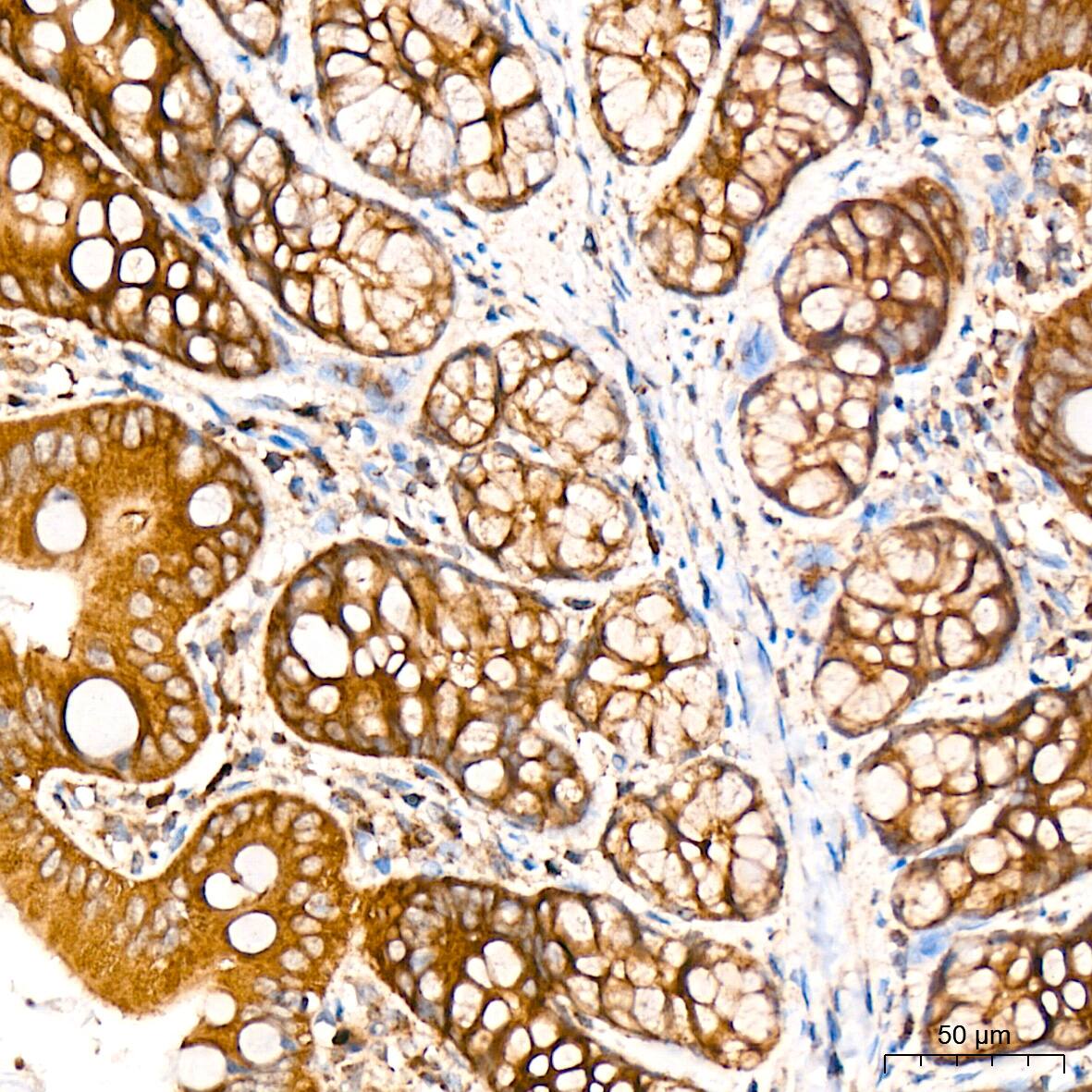 CS Citrate Synthase Antibody (4Z10Z8)