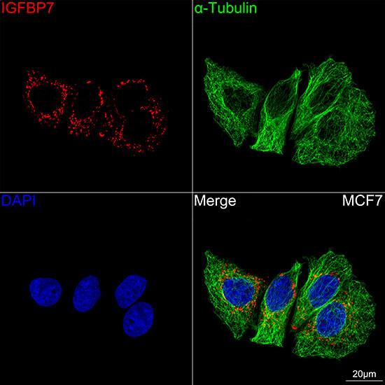 IGFBP-rp1/IGFBP-7 Antibody (8M10Q9)