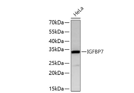 IGFBP-rp1/IGFBP-7 Antibody (8M10Q9)