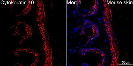 Cytokeratin 10 Antibody (4S5Y7)