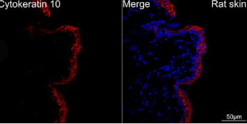 Cytokeratin 10 Antibody (4S5Y7)