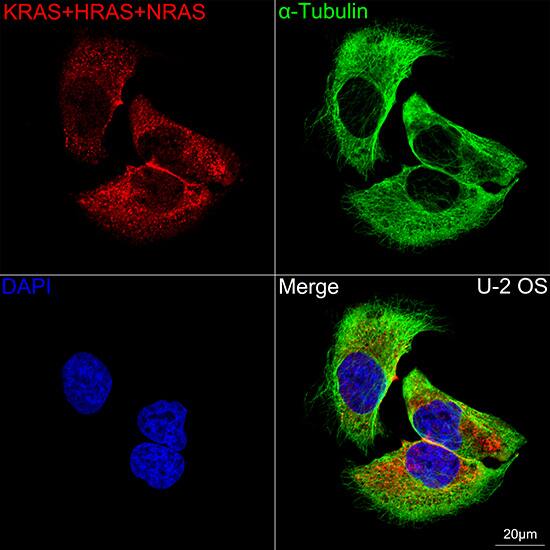 NRAS Antibody (6S6F3)