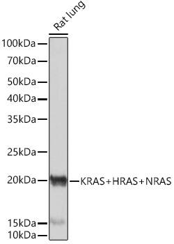 NRAS Antibody (6S6F3)